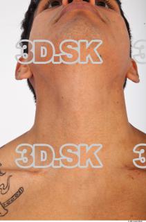 Neck reference of Mack 0001